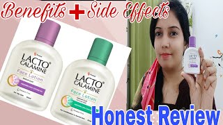 Lacto Calamine Face Lotion  Side Effects Of Lacto Calamine Face Lotion Lacto Calamine [upl. by Laleb]