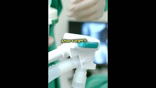 Breast surgery indications  procedure medicine surgeryeducation pharmacist diagnosis science [upl. by Tserof]