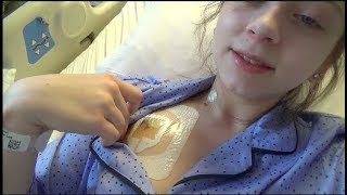 SURGERY VLOG PART TWO Going home But not for long [upl. by Audra231]