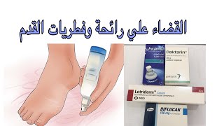 التخلص من رائحة القدم الكريهة والفطريات [upl. by Mlohsihc308]