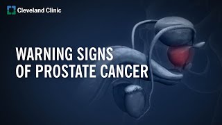 10 Warning Signs of Prostate Cancer [upl. by Leahcimdivad]