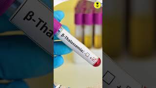 Beta Thalassemia  short  thecookbook  thalassemia [upl. by Groeg]