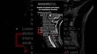 Impact of spinal cord injury on respiratory function [upl. by Serafina]