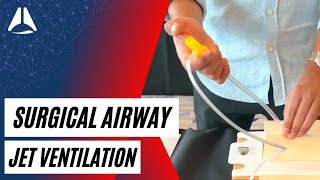 Jet Ventilation for CICO Emergencies  Airway Management [upl. by Wolfson165]