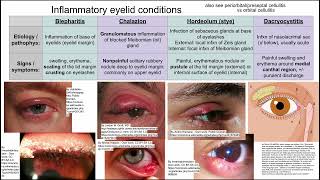 Inflammatory eyelid conditions [upl. by Anaimad489]