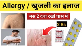 Itching Problem Treatment in Hindi  Khujli Ki Dawa  cetrizine amp betnesal  खुजली खत्म कैसे करे [upl. by Eserahc]