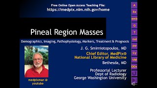 MedPix Video  Pineal Region Masses [upl. by Lletnom]