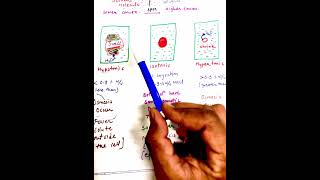 OsMosis  Reverse OsMosis  ISOTONIC HYPERTONICHYPOTONIC SOLUTIONs  SOLUTIONS 12th CBSE neet2025 [upl. by Hubey]