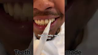 Teeth Whitening Pen removes stain amp discoloration teethwhitening tray dentist dentistry white [upl. by Ataynik108]