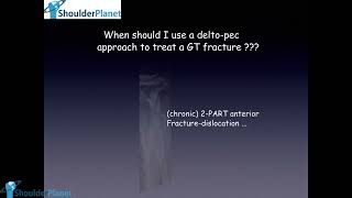 GREATER TUBEROSITY FRACTURES FROM ACUTE TO CHRONIC  MY WAY OF TREATMENT  TRANSOSSEOUS SUTURES [upl. by Akerdna489]