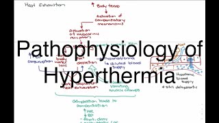 Hyperthermia Pathophysiology [upl. by Gypsy]