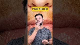 Pigmentation Around Mouth Skincare Routine for Glowing Skin [upl. by Kendrah2]