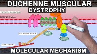 Duchenne Muscular Dystrophy [upl. by Reinertson]