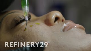 I Tried a Chemical Peel for Glass Skin BioRePeel  Macro Beauty  Refinery29 [upl. by Nimaynib780]