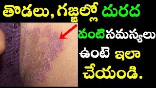 ఇలాచేస్తే చర్మ సమస్యలు మటుమాయం  Skin Infection In Telugu  Skin Disease  Itching [upl. by Ainafets]