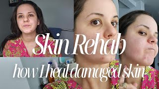 Skin Rehab  how I heal damaged skin [upl. by Tierney235]