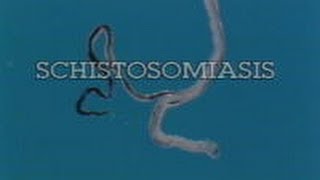 Schistosomiasis Pt 1 of 3 1990 [upl. by Ofella]