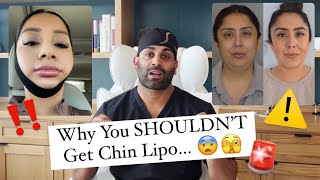 5 Reasons Why You SHOULDNT Get Chin Lipo [upl. by Egni]