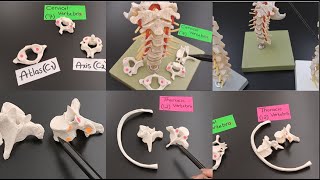 Vertebrae Anatomy  Cervical vs Thoracic vs Lumbar   Atlas vs Axis  Vertebral Column [upl. by Nnaik]