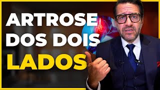 É possível ter ARTROSE dos DOIS LADOS Quais os RISCOS [upl. by Duggan]