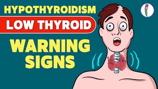 Signs that you have a Low Thyroid Level  Hypothyroidism  Signs amp Symptoms  Thyroid disease [upl. by Asyla]