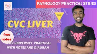 PATHOLOGY PRACTICAL  CVC LIVER with notes and viva questions [upl. by Isadora]