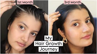 My 3 Months Experience of Using the Advanced Hair Growth serum [upl. by Romelda]