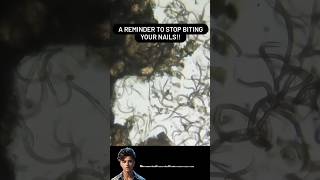 Nails Germs Under Microscope  Nails Germs 😱 shorts ytshorts microscopeview [upl. by Ailemap540]