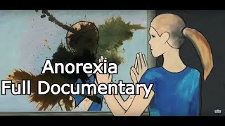 Anorexia  Modern Eating Disorder Treatment Documentary  Full HD [upl. by Yenor]