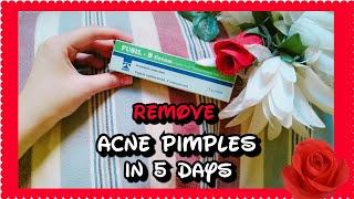 Fusil B cream review Remove Acne Pimples in 5 days  by Adan Expert 😊 [upl. by Annabella]