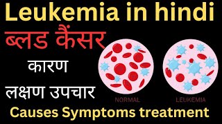 Leukemia in hindi  Blood cancer in hindi  Causes systems diagnosis treatment in hindi [upl. by Azpurua]