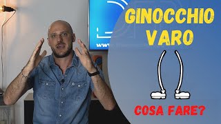 Ginocchio varo  Significato  Conseguenze  Soluzioni [upl. by Giffer266]