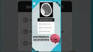 haemorrhage inicet neetmds facts dentalpractice [upl. by Pepi]