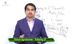 Trisomy 21  Downs syndrome  New [upl. by Davison]