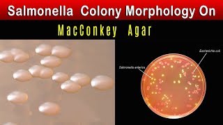 Salmonella Colony Morphology On MacConkey agar [upl. by Wearing]