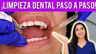 ¿CÓMO SE HACE UNA LIMPIEZA DENTAL DE CONSULTORIO  TE MUESTRO CADA PASO 🦷✅ [upl. by Yetnruoc]