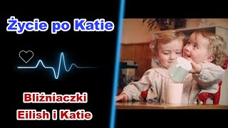 Eilish i Katie  bliźniaczki syjamskie [upl. by Eremehc]