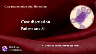 Patient case discussion case 1 [upl. by Neraa]