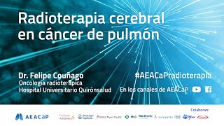 Radioterapia Cerebral en cáncer de pulmón [upl. by Pineda520]