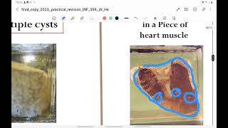 Practical parasitology Part 3 jars ptotozoa clinical pictures [upl. by Anit]