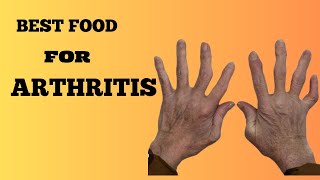 BEST FOOD FOR ARTHRITIS AND JOINT PAIN [upl. by Esital]