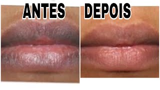 Como clarear os labios escuros causados do fumo [upl. by Season]