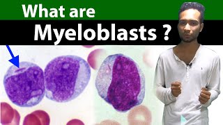 What are Myeloblasts   Clear amp Complete Overview [upl. by Audrit]