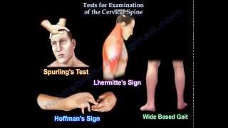 Tests For Examination Of The Cervical Spine  Everything You Need To Know  Dr Nabil Ebraheim [upl. by Nylrats]