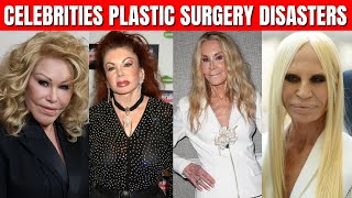 Top 10 Celebrities Plastic Surgery Disasters [upl. by Thesda]