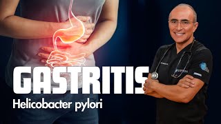 ¿Son sintomas de Gastritis o Bacteria Helicobacter Pylori [upl. by Pippy]