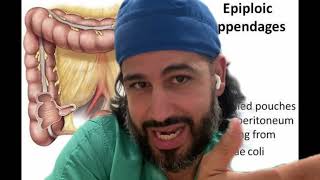 Epiploic Appendage Appendagitis [upl. by Oakman]