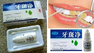 Yabanjing Teeth Whitening Review [upl. by Candide]