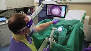 Cervical Rotating Biopsy Punch amp LLETZlearn® Training Simulator in Conjunction with DYSIS Medical [upl. by Glass]