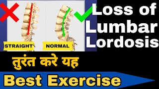 loss of lumbar Lordosis treatment in hindi Exercise for lower back painकमर दर्द का ईलाज backpain [upl. by Mayworm]